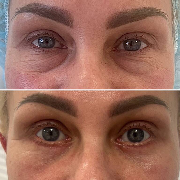 C91FA45F-0568-489D-8E24-153785E902F1