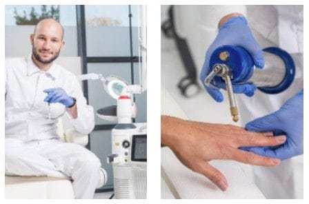 jak pozbyć się kurzajki