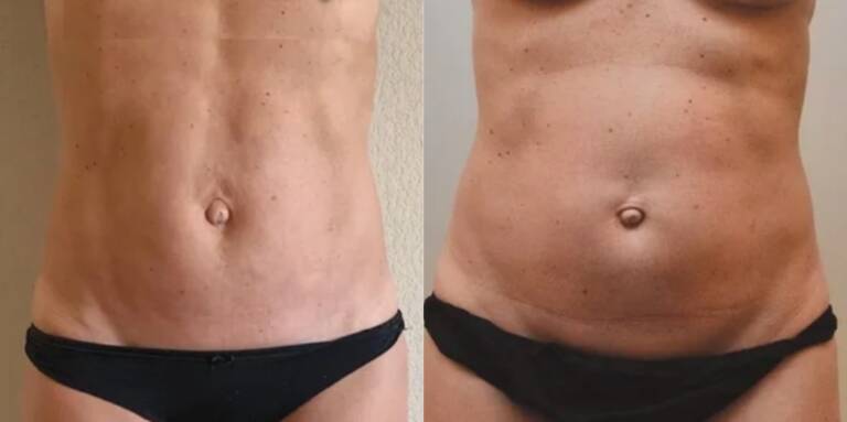 2AC341AD-E96B-487C-BD0C-85E59A95C235