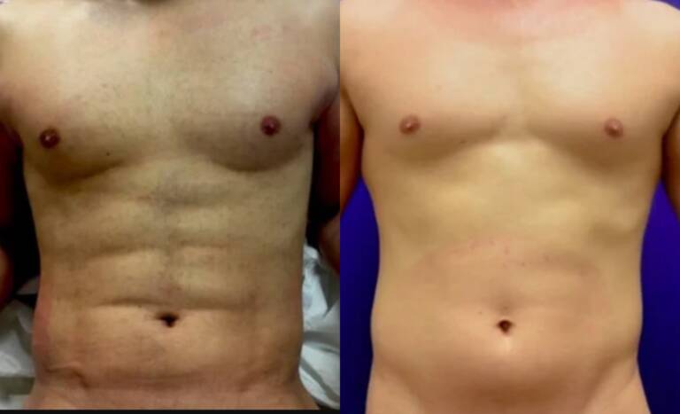 81BA0D9D-F576-424D-85C0-A6A82CCD9BDF