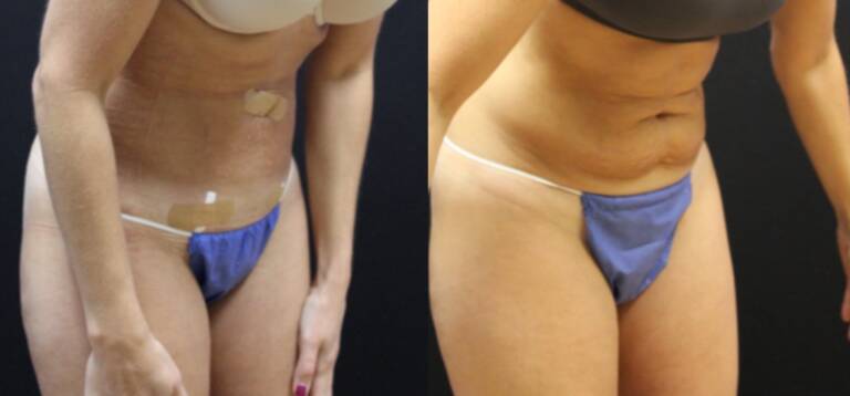 9E6185F6-66DF-48BD-B861-FF6741C9A7B1