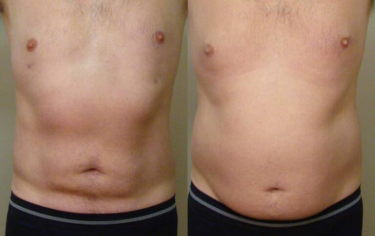 CDD7DD6F-F5BA-4B0A-AE9E-A4F7B553ED9C