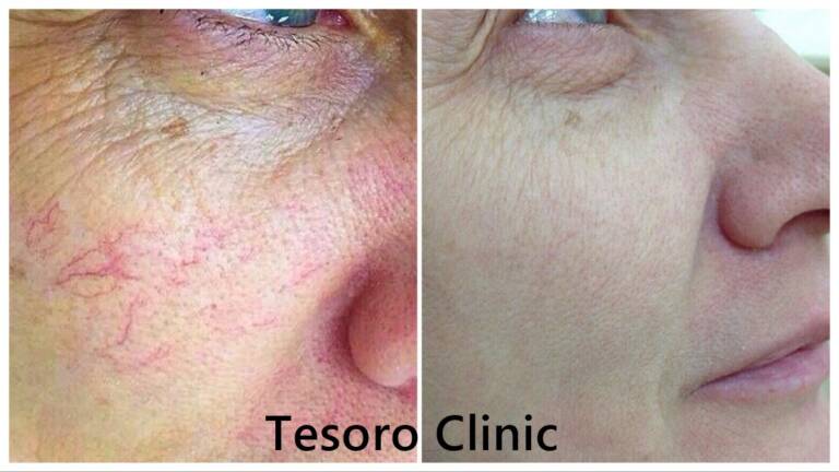 tesoro clinic
