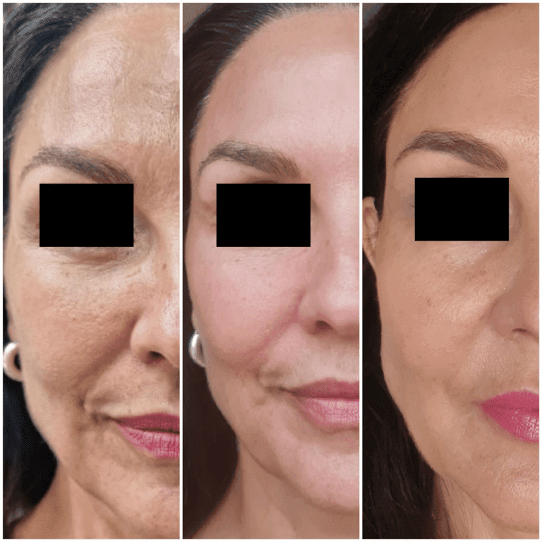 Tropokolagen GUNA Wrocław