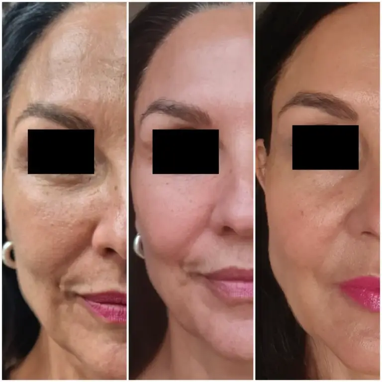 Tropokolagen GUNA Wrocław