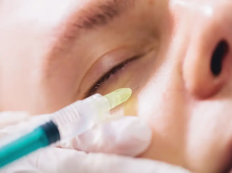 Wypełnianie doliny łez kwasem hialuronowym Wrocław